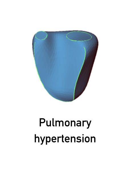 Pulmonary hypertension