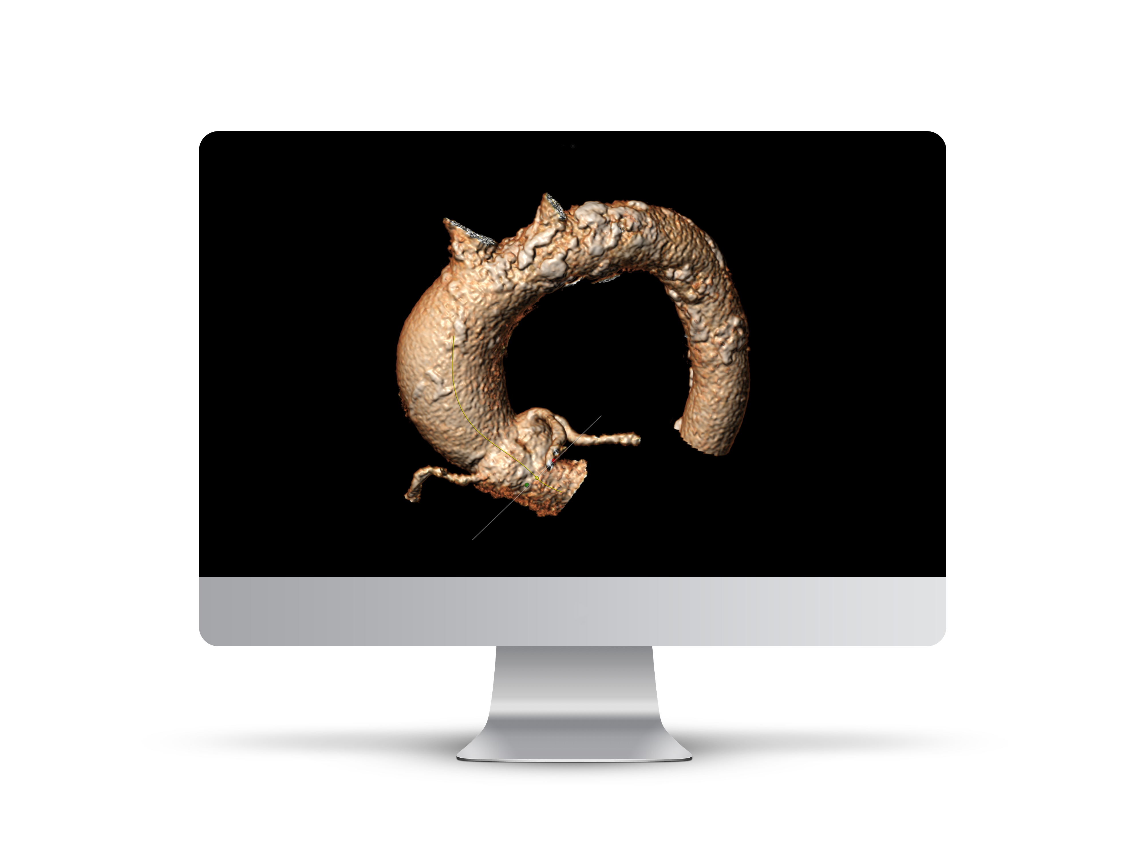 iMac_Aortic