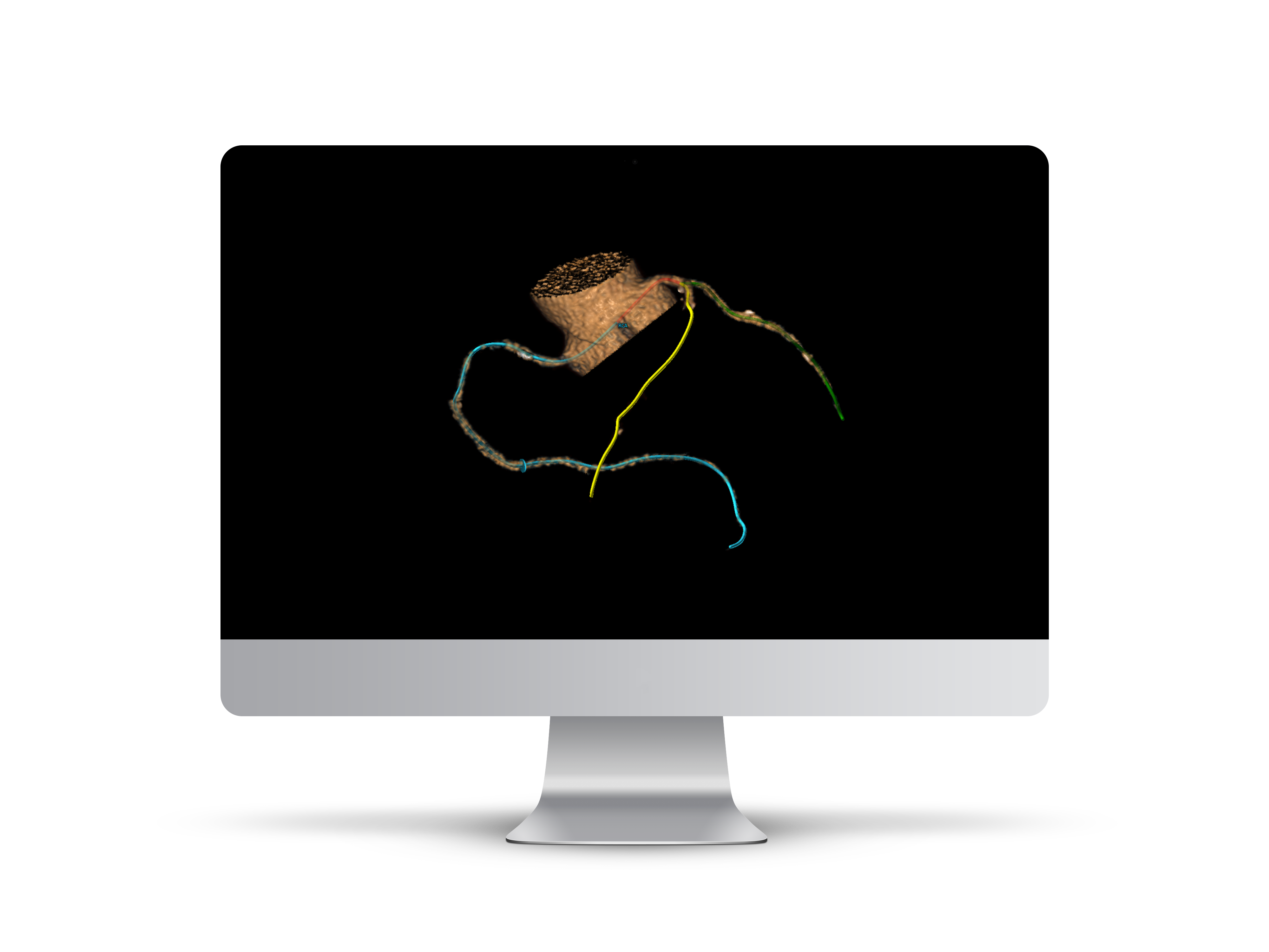 iMac_Koronar