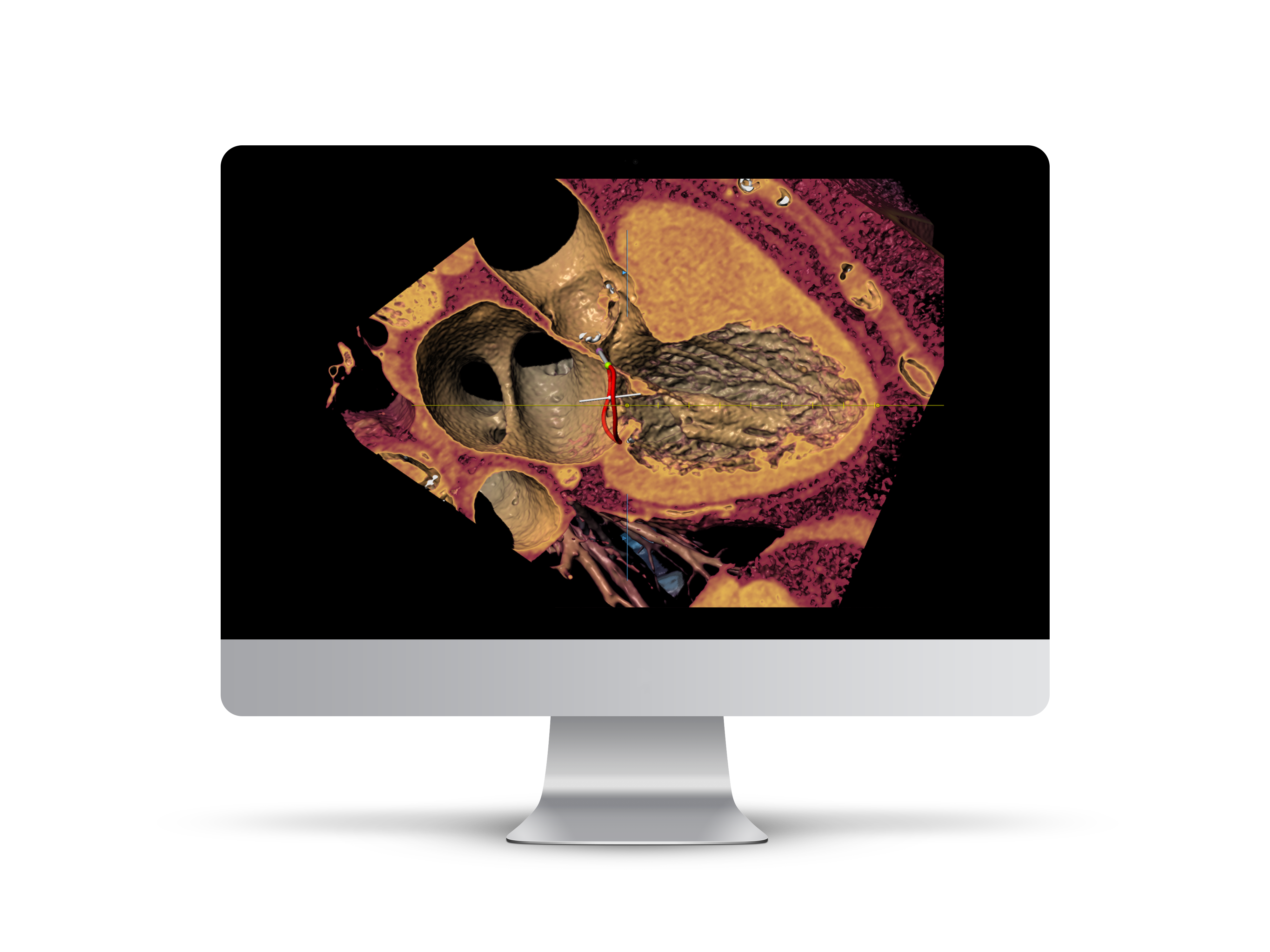 iMac_Mitral