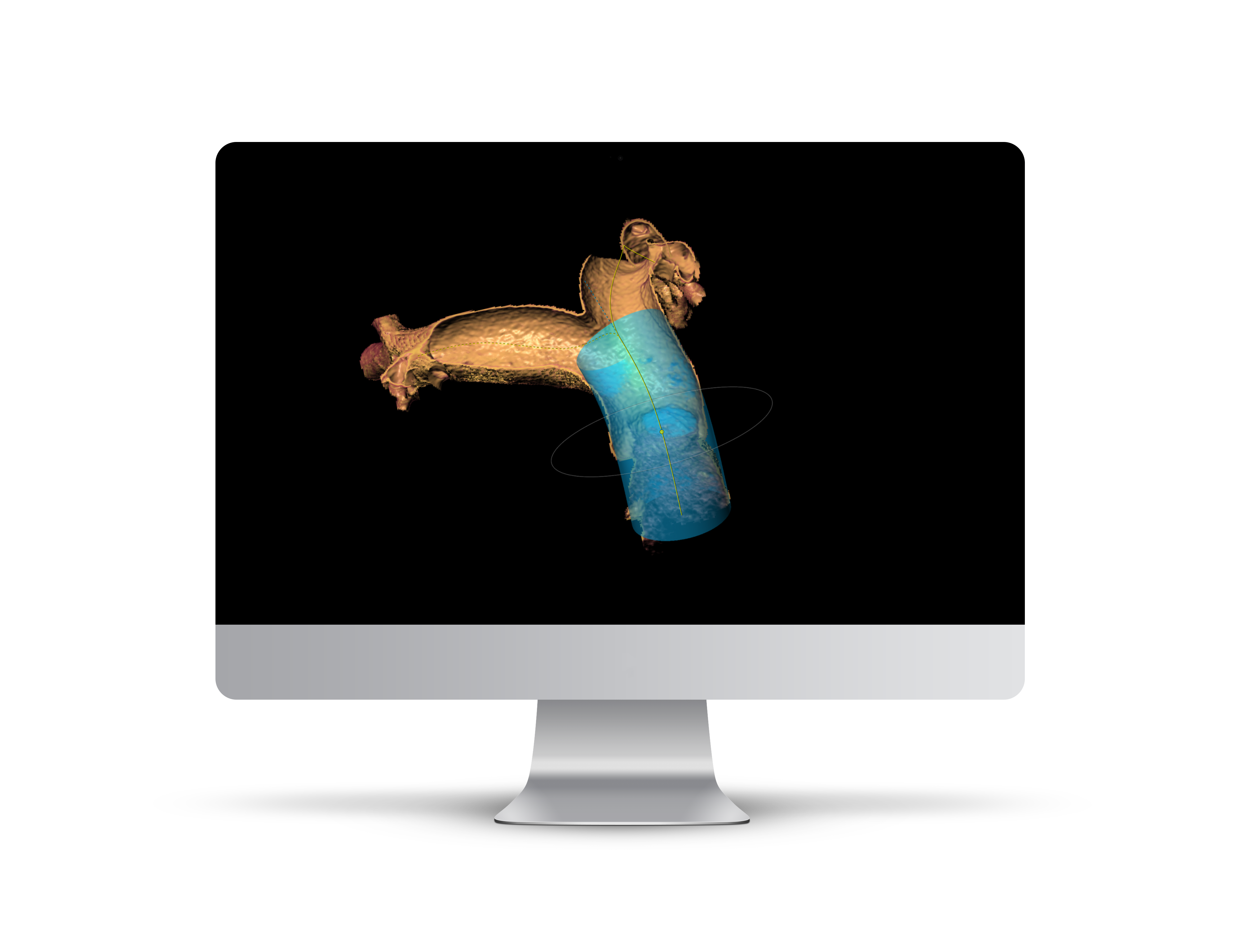 iMac_Pulmonary
